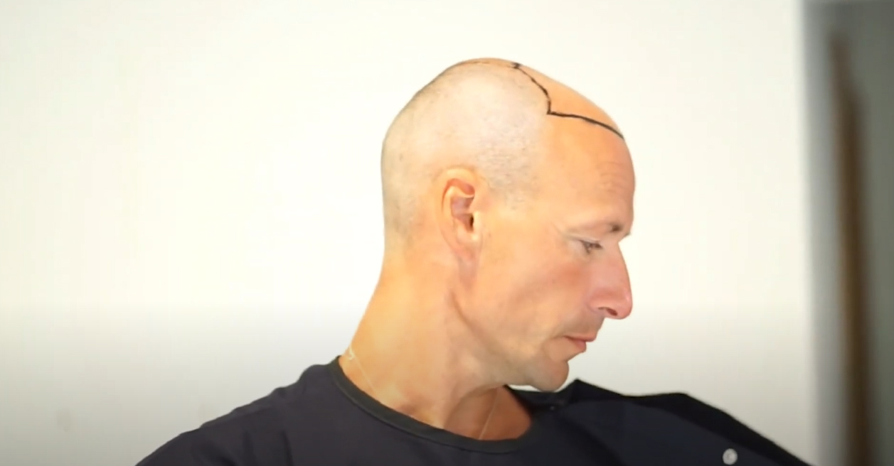 VATANMED Bosnien - Sehr zufriedene Kunden